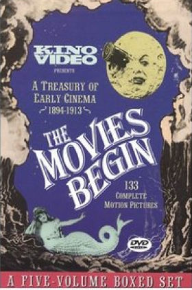 Troubles of a Manager of a Burlesque Show